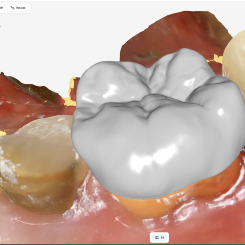 alt="digital dentistry 3D scan same day crowns invisalign Richmond NSW"