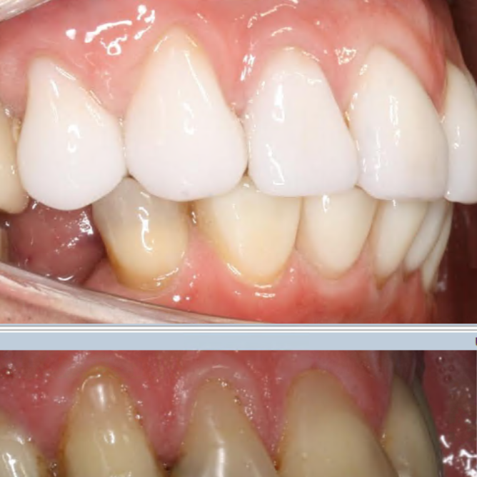 alt="digital dentistry 3D scan same day crowns invisalign Richmond NSW"